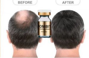 cach-dung-thuoc-moc-toc-bombit-hsc-ampoule-hieu-qua-tu-chuyen-gia